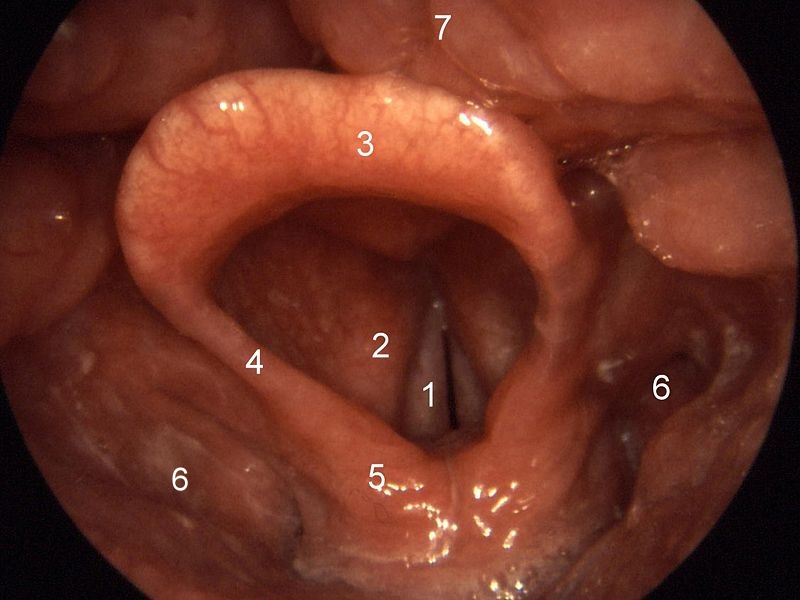 Larynx von kranial